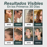 Oasis™ Cabezal Ducha 7 Modos con Filtro - Salva Tu Piel, Tu Pelo y Tu Salud del Desastre 3