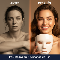 Mascara LED Facial Pro 7 Colores | Piel Radiante y Sin Imperfecciones 4