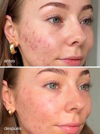 Máscara LED Facial 7 Colores Terapia Luz - Anti Acné Anti Arrugas 2